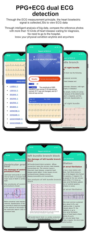 2022 Latest online smart watch wearable device  PPG AI medical diagnosis health care  prsessure oxygen band smartwatches