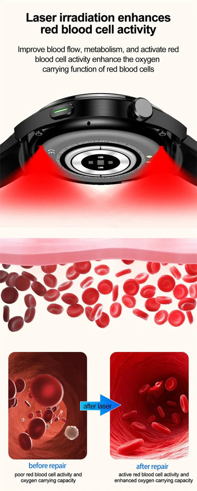 2024 Latest Health Smart Watch F320 with Laser Therapy Phone Call Blood Glucose Uric Acid and Lipid Monitoring Health Watch